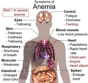 anemia jpg pic final